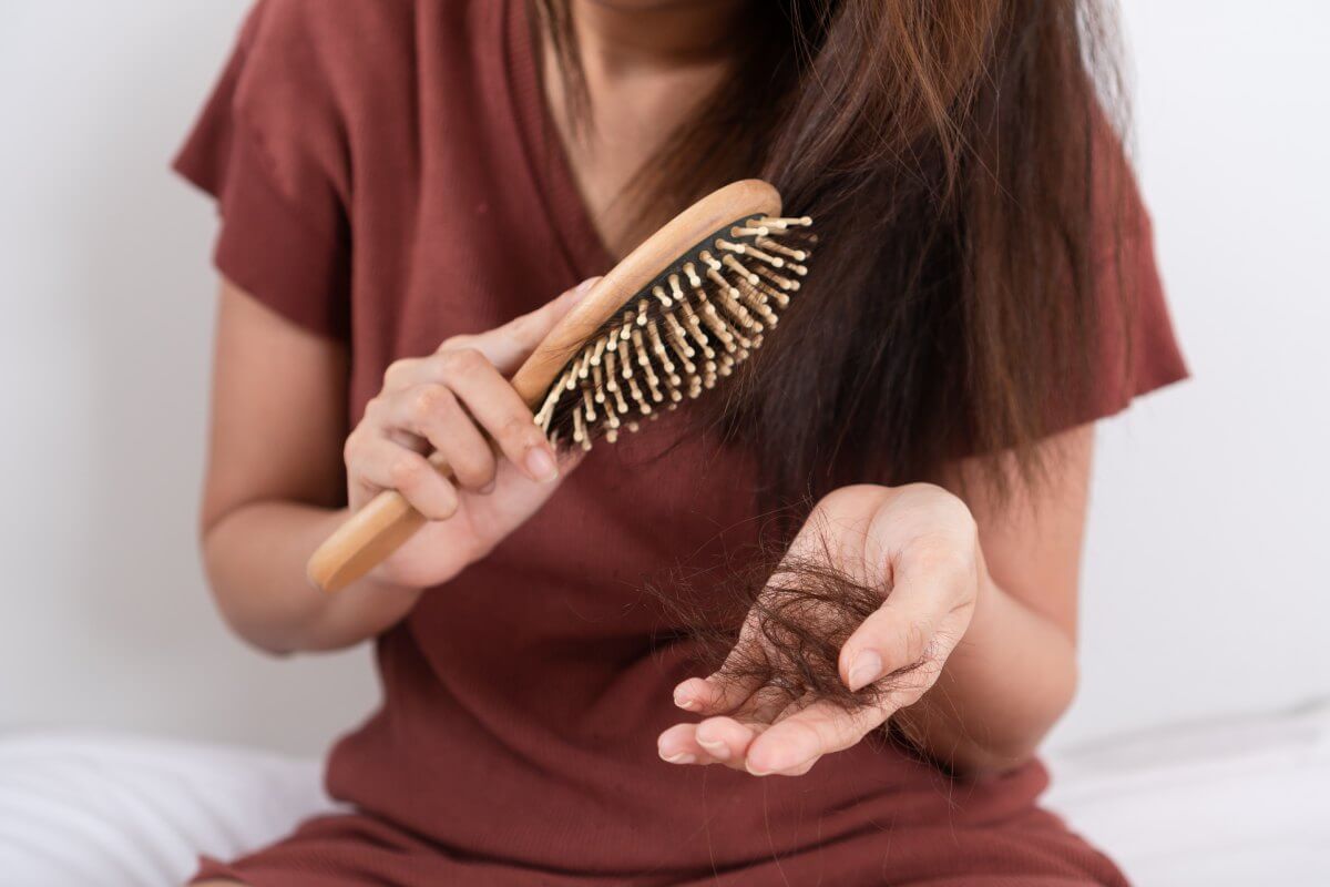 Rụng tóc nhiều là bệnh gì? Có nguy hiểm hay không?